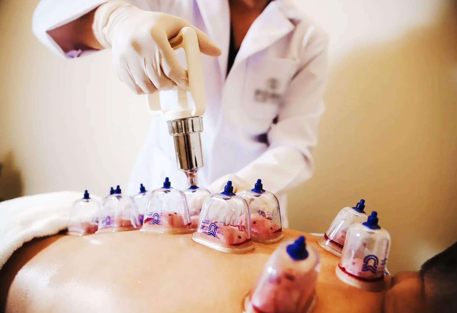 Tubuh Penuh Keluhan Tapi Masih Cari Bekam dan Ruqyah Murah Meriah Serta Asal-asalan