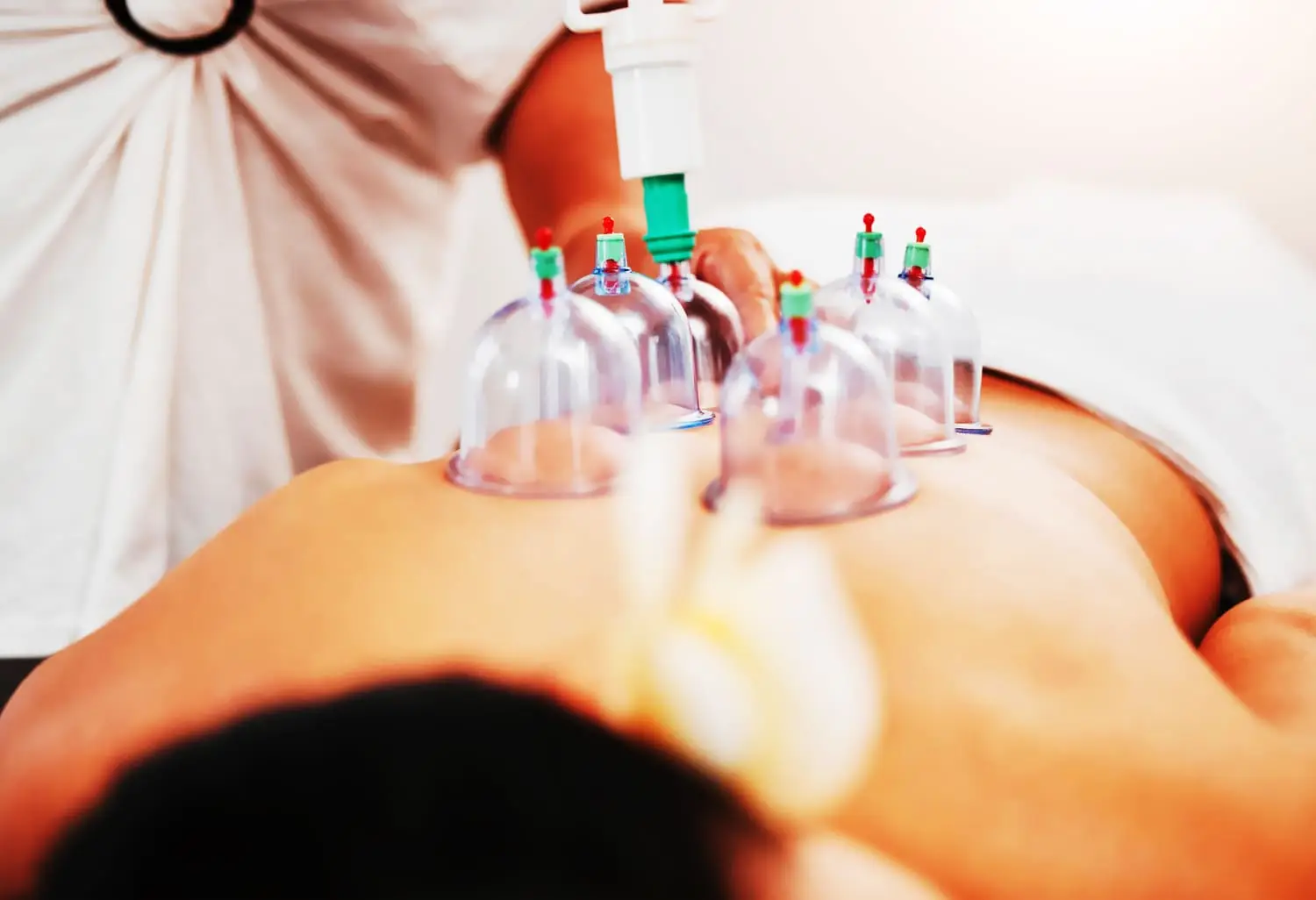 Tempat Bekam Batam, Rekomendasi Tempat Bekam di Batam, Tempat Bekam Terdekat dan Klinik Bekam Terdekat Batam